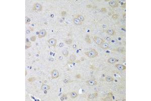 Immunohistochemistry of paraffin-embedded mouse brain using YES1 antibody at dilution of 1:100 (40x lens). (YES1 antibody)