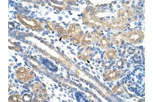 RPUSD2 antibody was used for immunohistochemistry at a concentration of 4-8 ug/ml to stain Epithelial cells of renal tubule (arrows) in Human Kidney. (RPUSD2 antibody  (N-Term))