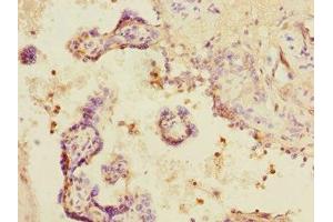 Immunohistochemistry of paraffin-embedded human placenta tissue using ABIN7160270 at dilution of 1:100 (DCP1A antibody  (AA 303-582))