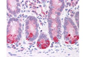 LRRC59 antibody was used for immunohistochemistry at a concentration of 4-8 ug/ml. (LRRC59 antibody  (N-Term))