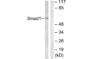 Western blot analysis of extracts from 293 cells, using Smad1 (epitope around residue 187) antibody. (SMAD1 antibody  (Ser187))