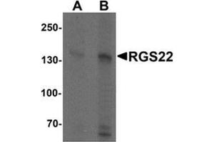 Western blot analysis of RGS22 in Jurkat cell lysate with RGS22 Antibody  at (A) 1 and (B) 2 μg/ml.