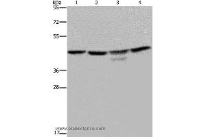 Western blot analysis of K562 and 293T cell, Jurkat cell and mouse brain tissue, using CSNK2A1 Polyclonal Antibody at dilution of 1:300 (CSNK2A1/CK II alpha antibody)