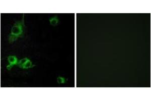 Immunofluorescence analysis of COS7 cells, using LAMA1 Antibody. (Laminin alpha 1 antibody  (AA 2501-2550))