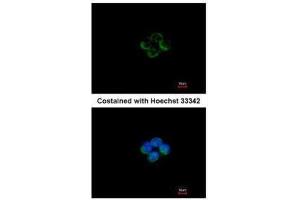 ICC/IF Image Immunofluorescence analysis of methanol-fixed A431, using ACADM, antibody at 1:200 dilution. (Medium-Chain Specific Acyl-CoA Dehydrogenase, Mitochondrial (MCAD) (Center) antibody)