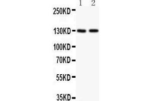 Anti-Hamartin Picoband antibody,  All lanes: Anti Hamartin  at 0. (TSC1 antibody  (AA 686-884))