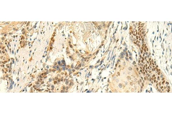HMBOX1 antibody