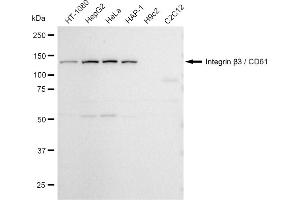 Western blotting analysis using Integrin β3 / CD61 antibody (ABIN7799071).