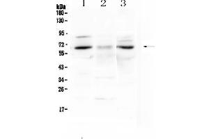 Western blot analysis of CCKBR using anti-CCKBR antibody . (CCKBR antibody)