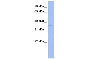 WB Suggested Anti-TLX3 Antibody Titration:  0. (TLX3 antibody  (N-Term))