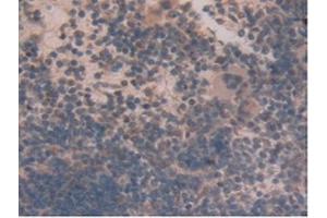IHC-P analysis of Mouse Spleen Tissue, with DAB staining. (GLUD1 antibody  (AA 65-273))