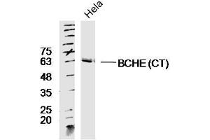 Lane 1: HeLa lysates probed with Rabbit Anti-BCHE Polyclonal Antibody, Unconjugated  at 1:300 overnight at 4˚C. (Butyrylcholinesterase antibody  (AA 505-602))