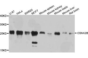 Western blot analysis of extracts of various cell lines, using CSNK2B antibody.
