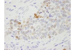 Immunohistochemistry (IHC) image for anti-Importin Subunit alpha-1 (KPNA2) (C-Term) antibody (ABIN7448767) (Importin Subunit alpha-1 (KPNA2) (C-Term) antibody)