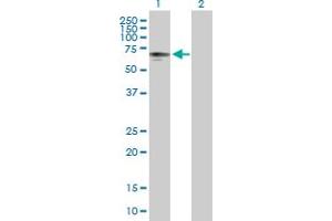 Western Blot analysis of P4HTM expression in transfected 293T cell line by P4HTM MaxPab polyclonal antibody. (P4HTM antibody  (AA 1-563))