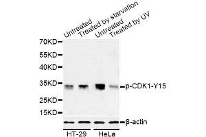 Western blot analysis of extracts of HT-29 and HeLa cells, using Phospho-CDK1-Y15 antibody (ABIN5969877) at 1/1000 dilution. (CDK1 antibody  (pTyr15))