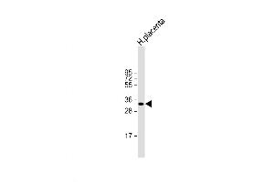 Western Blot at 1:2000 dilution + human placenta lysate Lysates/proteins at 20 ug per lane. (HPGD antibody  (C-Term))