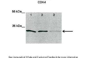 Lanes:  Lane1: 30 ug untreated human HCT116 cell lysate Lane2-3: 30 ug genotoxic agent treated human HCT116 cell lysate Primary Antibody Dilution:  1:2000 Secondary Antibody:  Anti-rabbit HRP Secondary Antibody Dilution:  1:5000 Gene Name:  CDK4 Submitted by:  Anke Rauch & Dr.