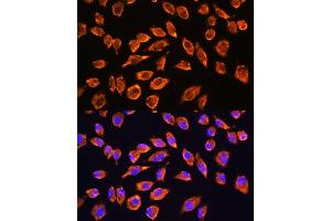 Immunofluorescence analysis of L929 cells using NMDA Rabbit pAb (ABIN1681064, ABIN3015387, ABIN3015389 and ABIN6214028) at dilution of 1:100. (NMDAR2A antibody  (AA 1130-1400))
