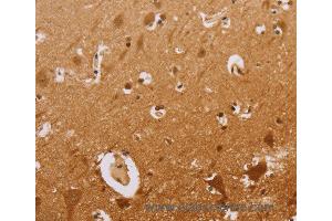 Immunohistochemistry of Human brain  using CEL Polyclonal Antibody at dilution of 1:50 (Cholesterol Esterase antibody)