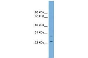 Image no. 1 for anti-RNA Binding Motif Protein 11 (RBM11) (C-Term) antibody (ABIN6744703) (RBM11 antibody  (C-Term))