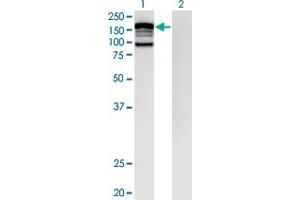 Western Blot analysis of CLIP2 expression in transfected 293T cell line by CLIP2 monoclonal antibody (M07), clone 3H5. (CLIP2 antibody  (AA 946-1046))