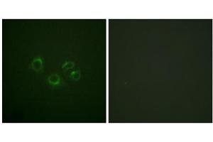 Immunofluorescence analysis of A549 cells, using EPHA2/3/4 (epitope around residue 588/596) antibody. (EPHA2/3/4 antibody  (Tyr588, Tyr596))