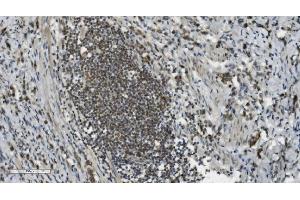 IHC analysis of PARP using anti-PARP antibody (ABIN7602278). (PARP1 antibody  (AA 670-858))