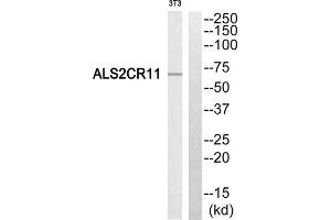 Western Blotting (WB) image for anti-Amyotrophic Lateral Sclerosis 2 (Juvenile) Chromosome Region, Candidate 11 (ALS2CR11) (C-Term) antibody (ABIN1850754) (ALS2CR11 antibody  (C-Term))