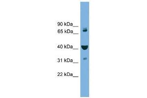 Western Blot showing VPS16 antibody used at a concentration of 1-2 ug/ml to detect its target protein. (VPS16 antibody  (Middle Region))