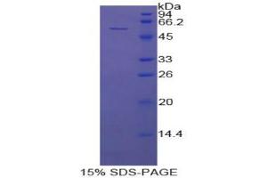 SDS-PAGE analysis of Cow Fibrinogen beta Protein. (Fibrinogen beta Chain Protein (FGB))