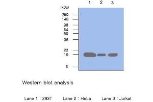 Cell lysates of 293T, HeLa and Jurkat (each 50 µg) were resolved by SDS-PAGE, transferred to PVDF membrane and probed with anti-human Pin1 (1:500). (PIN1 antibody  (N-Term))