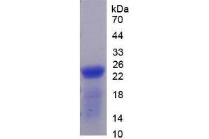 SDS-PAGE of Protein Standard from the Kit (Highly purified E. (Thrombospondin 1 ELISA Kit)