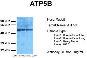 Host:  Rabbit  Target Name:  ATP5B  Sample Tissue:  Human Fetal Liver, Human Fetal Lung, Human Ovary Tumor, Human 786-0  Antibody Dilution:  1. (ATP5B antibody  (C-Term))