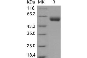 Western Blotting (WB) image for Vanin 1 (VNN1) protein (His tag) (ABIN7320101) (VNN1 Protein (His tag))