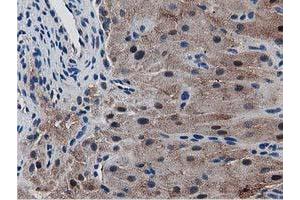 Image no. 2 for anti-Sequestosome 1 (SQSTM1) antibody (ABIN1499988) (SQSTM1 antibody)