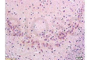 Formalin-fixed and paraffin embedded: rat brain tissue labeled with Anti-FLIP/c FLIP Polyclonal Antibody (ABIN725255), Unconjugated at 1:300 followed by conjugation to the secondary antibody and DAB staining