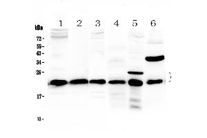 Western blot analysis of PARK7 / DJ1 using anti-PARK7 / DJ1 antibody . (PARK7/DJ1 antibody  (AA 2-189))