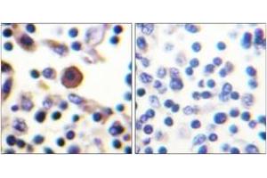 Immunohistochemistry (IHC) image for anti-Interleukin 9 Receptor (IL9R) (AA 472-521) antibody (ABIN2888887) (IL9 Receptor antibody  (AA 472-521))