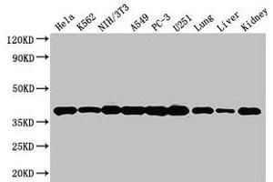 Western Blot Positive WB detected in: Hela whole cell lysate, K562 whole cell lysate, NIH/3T3 whole cell lysate, A549 whole cell lysate, PC-3 whole cell lysate, U251 whole cell lysate, Mouse lung tissue, Mouse liver tissue, Mouse kidney tissue All lanes: ANXA2 antibody at 3 μg/mL Secondary Goat polyclonal to rabbit IgG at 1/50000 dilution Predicted band size: 39, 41 kDa Observed band size: 39 kDa (Annexin A2 antibody  (AA 2-339))