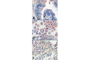 Immunohistochemistry (IHC) image for anti-Toll-Like Receptor 9 (TLR9) antibody (ABIN6656659)