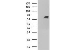 Image no. 5 for anti-Insulin-Like Growth Factor 2 mRNA Binding Protein 2 (IGF2BP2) antibody (ABIN1498822)