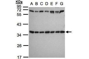 WB Image Sample(30 ug whole cell lysate) A: 293T B: A431 , C: H1299 D: HeLa S3 , E: Hep G2 , F: MOLT4 , G: Raji , 12% SDS PAGE antibody diluted at 1:1000 (RPS3A antibody)