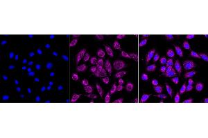 anti-Prohibitin 2 (PHB2) antibody