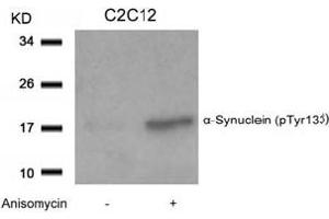 Image no. 2 for anti-Synuclein, alpha (SNCA) (pTyr133) antibody (ABIN401574) (SNCA antibody  (pTyr133))
