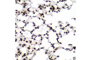 Immunohistochemistry of paraffin-embedded mouse lung using TEAD1 antibody at dilution of 1:100 (x40 lens). (TEAD1 antibody)