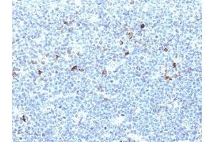 Formalin-fixed, paraffin-embedded human tonsil stained with HLA-Aw32 / HLA-A25 antibody (CATA-1). (HLA-Aw32-&-HLA-A25 (MHC-I) antibody)