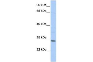 WB Suggested Anti-TGIF2LX Antibody Titration:  0. (TGIF2LX antibody  (Middle Region))