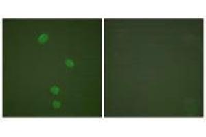 Immunofluorescence analysis of HepG2 cells, using MCM5 antibody. (MCM5 antibody)