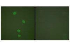 Immunofluorescence analysis of HepG2 cells, using MCM5 antibody. (MCM5 antibody)